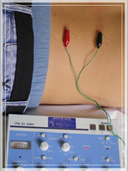 Electro Acupuncture