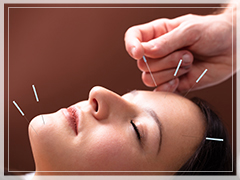 Facial Acupuncture