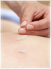 Acupuncture for PCOS