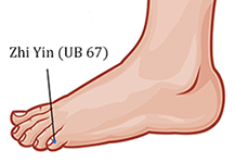 UB67 for Breech Pregnancy